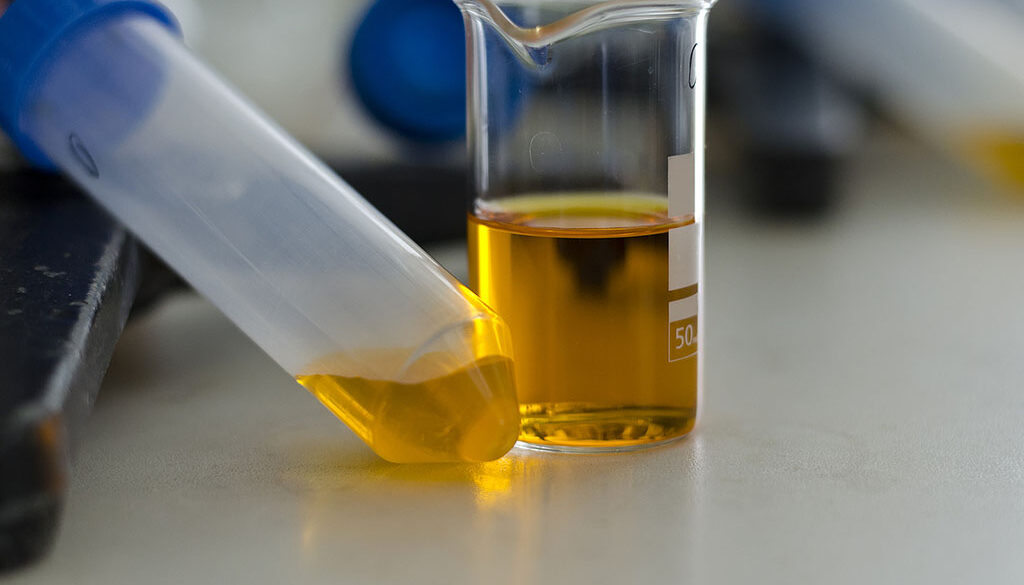 Closeup of a Vial & Beaker Filled With Dark Yellow Urine What Does the Color of Your Urine Mean