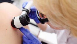 Closeup of a Dermatologist Using a Device to Inspect a Mole on a Patient’s Back Is Skin Cancer Genetic